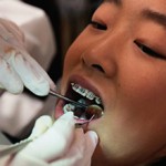 Сколько стоит консультация у ортодонта и от чего зависит стоимость