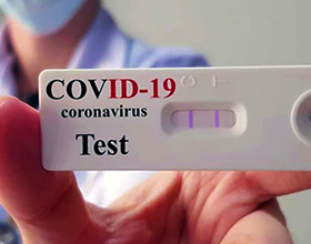 Сколько стоит тест на коронавирус