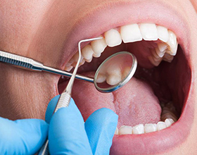 Сколько стоит чистка зубов в стоматологии?