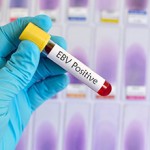 Сколько стоит анализ крови на вирус Эпштейна-Барр — примерные цены