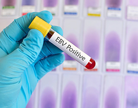 Сколько стоит анализ крови на вирус Эпштейна-Барр — примерные цены