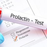 Сколько стоит анализ на пролактин — средние цены