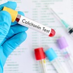 Сколько в среднем стоит сдать анализ на кальцитонин?