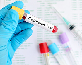 Сколько в среднем стоит сдать анализ на кальцитонин?