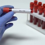 Сколько стоит анализ на цинк в крови?