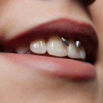 Сколько стоит сделать пирсинг уздечки губы (смайл)?