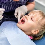 Сколько в среднем стоит удалить молочный зуб у ребенка?
