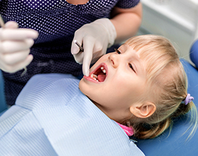 Сколько в среднем стоит удалить молочный зуб у ребенка?